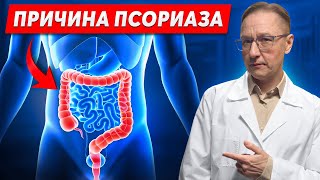 Как появляется псориаз? ПРИЧИНА дырявый кишечник