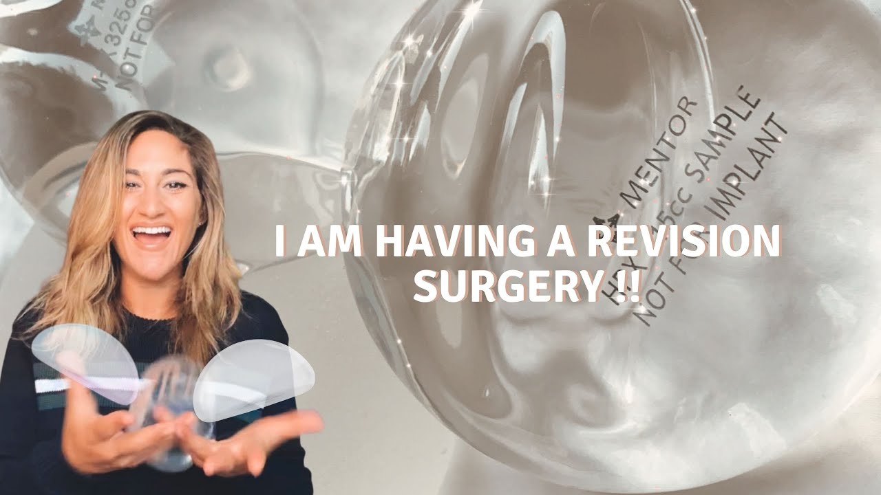 I'M HAVING A REVISION SURGERY: WHY I'M DOING THIS &amp; WHAT I WISH I KNEW