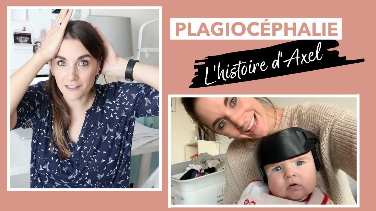 Plagiocephalie Et Casque Youtube