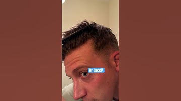 Wat biedt een realistischere haarlijn?