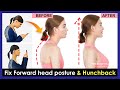 Just 5 minutes!! How to fix forward head posture and fix Hunchback (Easy 5 Exercises)