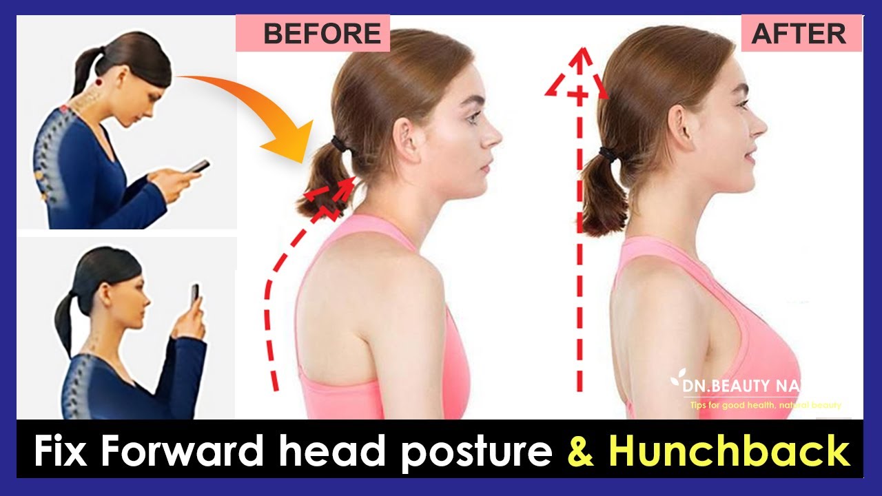 Just 5 minutes!! How to fix forward head posture and fix Hunchback