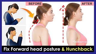 Just 5 minutes!! How to fix forward head posture and fix Hunchback (Easy 5 Exercises)