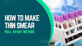 Perfect Blood Smear Using Pull-Apart Method | MLT Practical Made Easy!
