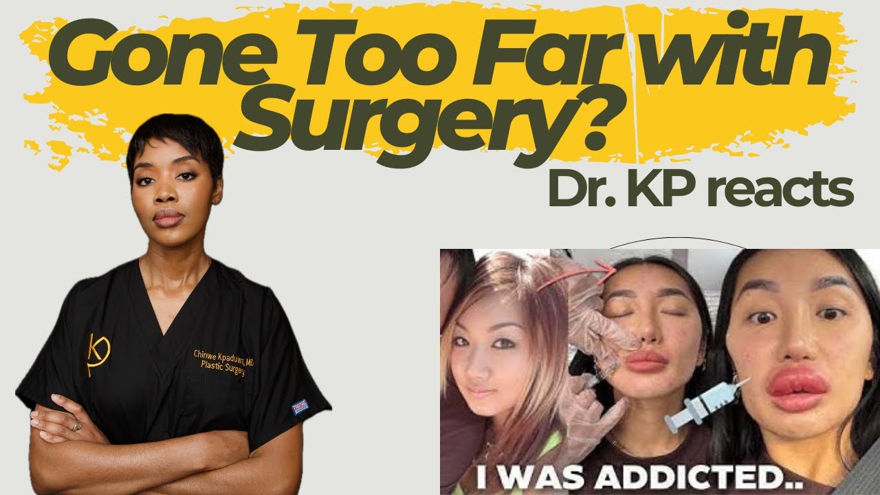 Did she go too far with plastic surgery? A plastic surgeon reacts