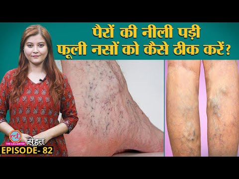 वीडियो: स्वस्थ, स्वच्छ और अच्छे दिखने वाले पैर कैसे पाएं (चित्रों के साथ)