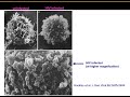 Lect7 Pathogenesis & Host Defenses
