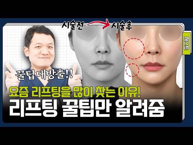 리프팅이 미친 듯이 인기 있는 진짜 이유🔥