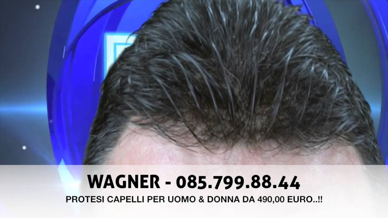 no trapianto capelli no alopecia parrucchino protesi capelli soluzione  wagner - YouTube