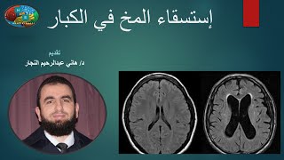 إستسقاء المخ في البالغين وكبار السن - (متلازمة حكيم آدم) - طرق تشخيصه وعلاجه = د/ هاني النجار