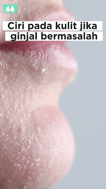 Ciri Pada Kulit Jika Ginjal Bermasalah  #gagalginjal  #polahidupsehat #faktamenarik