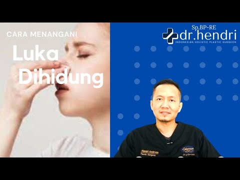 Video: Cara Menyembuhkan Luka Hidung (dengan Gambar)