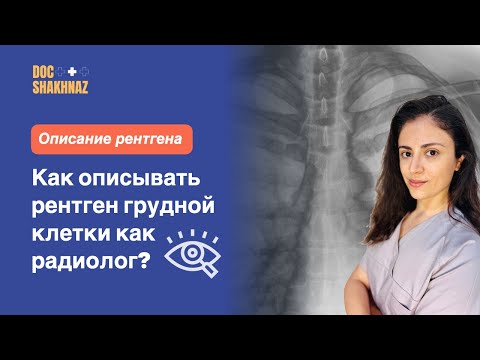 РЕНТГЕН грудной клетки. Как читать рентген как радиолог?