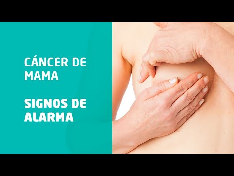 Video: Cómo reconocer el cáncer de mama en casa