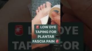 Low Dye Taping For Plantar Fasciitis Pain Aleks Physio