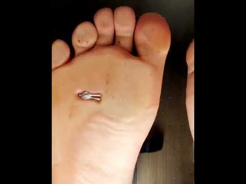 Dirty Barefeet Underglass