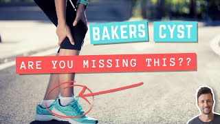 BAKERS CYST Exercises You Probably Aren’t Doing (But Absolutely Should) | Cause Explained!