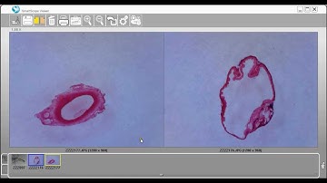 SmartMicroScope -- Using the Compare Feature