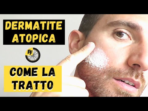Video: 13 modi per trattare l'eczema in modo naturale