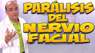 PARÁLISIS del NERVIO FACIAL, Qué es, CAUSAS, tipos, SÍNTOMAS, DIAGNÓSTICO y TRATAMIENTO