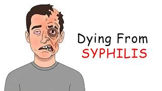 What Dying from Syphilis Feels Like
