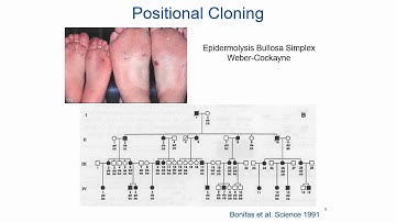Optical Mapping in Rare Genetic Disease Diagnosis