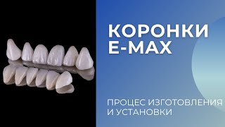 Коронки E-MAX - изготовление, установка  и преимущества