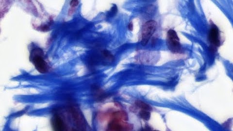 Collagen by Trichrome and Second-Harmonic Generation