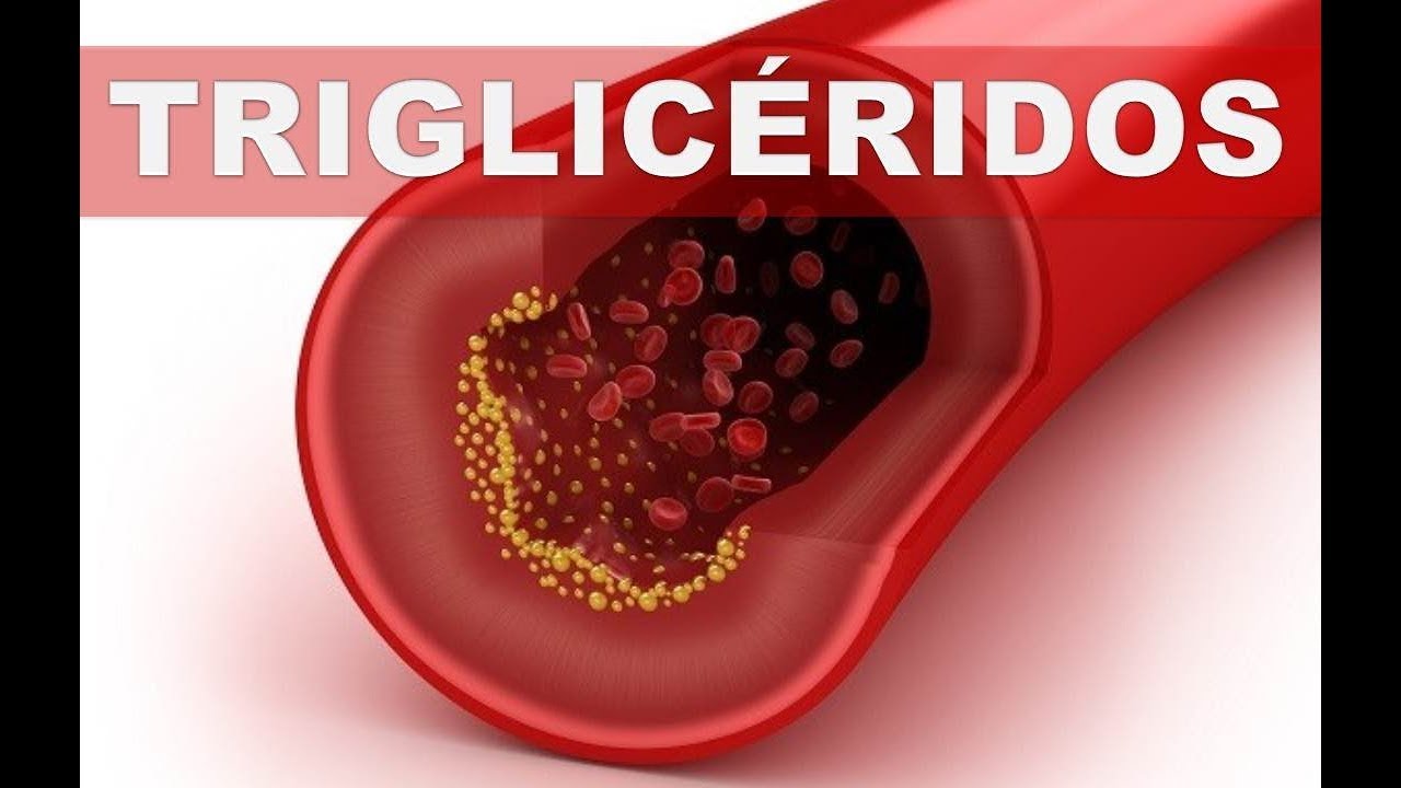 Triglicéridos bajos y colesterol alto