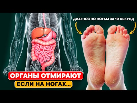 Видео: Так СТАРЫЕ ВРАЧИ определяют БОЛЕЗНИ. Методы раннего определения болезней по ногам