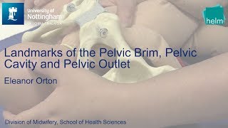 Landmarks of the Pelvic Brim, Pelvic Cavity and Pelvic Outlet