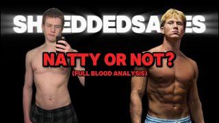 Natty or Not (Blood Test Results)