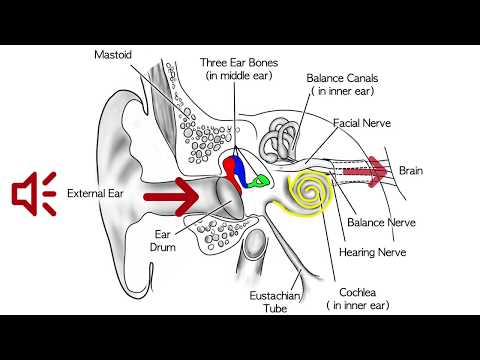 What is a Glomus Tympanicum?