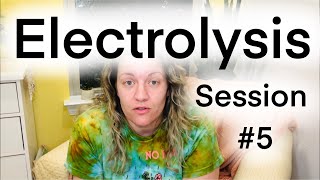 13 HOURS of Electrolysis facial hair removal | Beard Progress CLOSE UP | PCOS/Hirsutism Support