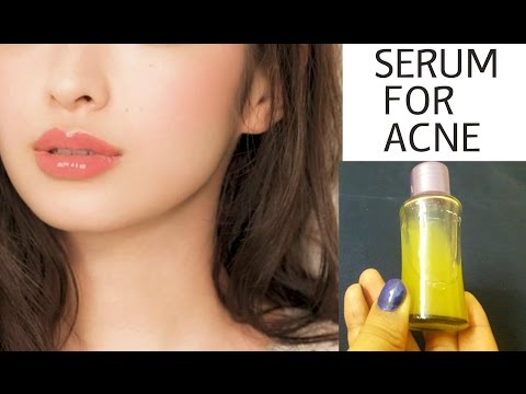 Homemade Facial Serum To Remove Pimples & Acne |Serum For Acne Prone Skin