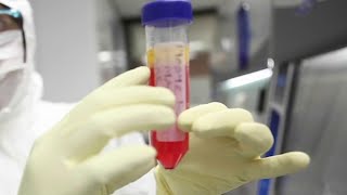 A San Antonio doctor says stem cells may make a difference in COVID-19 treatments