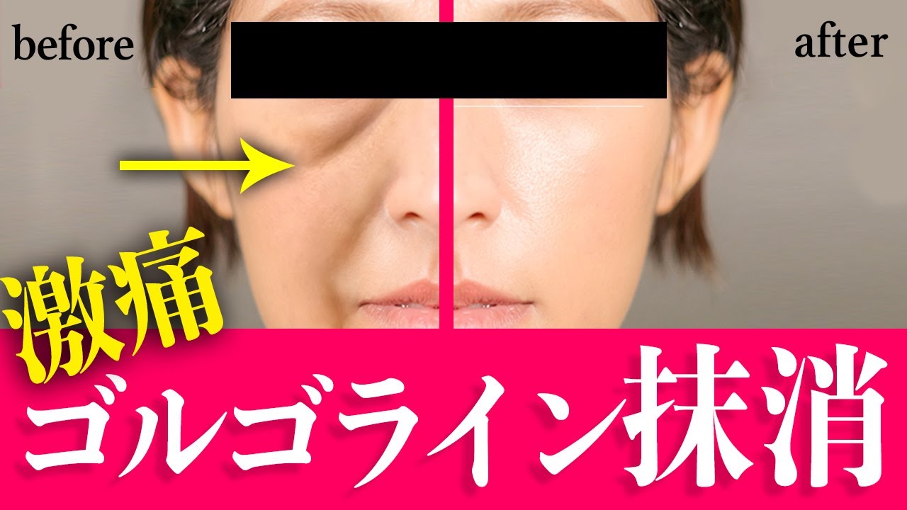 Сильная боль Талми Голголин Сильнейшее стереть