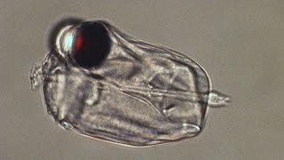 Single-celled sniper uses one eye to hunt Wealth