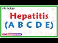 Hepatitis ( A  B C D E ) - Pathology Lectures for FMGE and NEET PG
