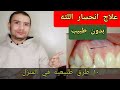 علاج انحسار اللثه | 10 طرق سحريه لعلاج تراجع اللثه في المنزل بدون طبيب