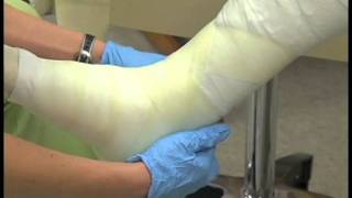 Putting On a Cast - Medical Assistant Skills Video #8