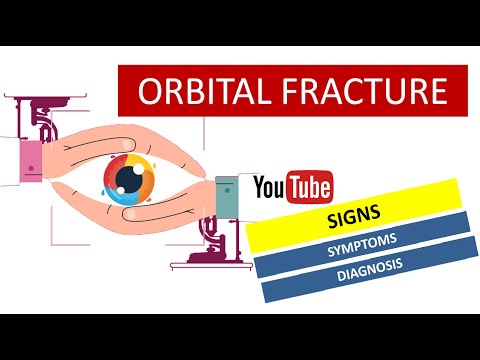 Orbital Fracture - Signs, Symptoms & Diagnosis | PODCAST