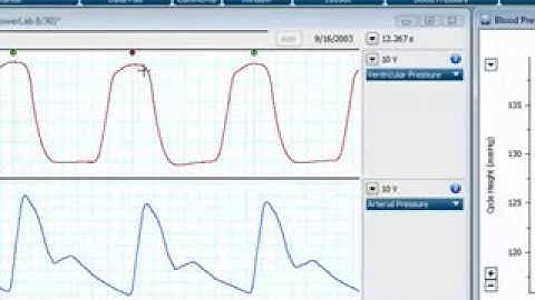 LabChart血壓分析模組使用教學