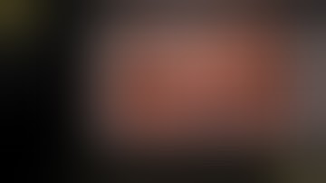 Laparoscopic vs robotic pancreatectomy