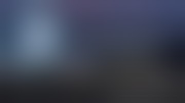 Robotic Proximal Gastrectomy with Modified- Side Overlap with Fundoplication Reconstruction