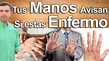 ¿Por qué tengo las manos tensas?