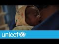 Indias smallest baby  unicef