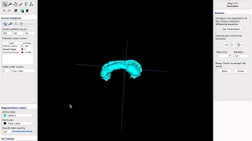 Renderización ITK-SNAP