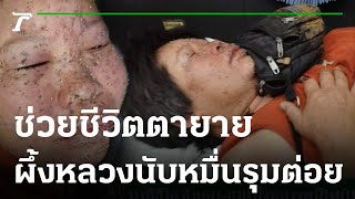 นาทีชีวิต ช่วยตา-ยาย ผึ้งหลวงหนีไฟป่ารุมต่อย | 23-02-66 | ข่าวเที่ยงไทยรัฐ