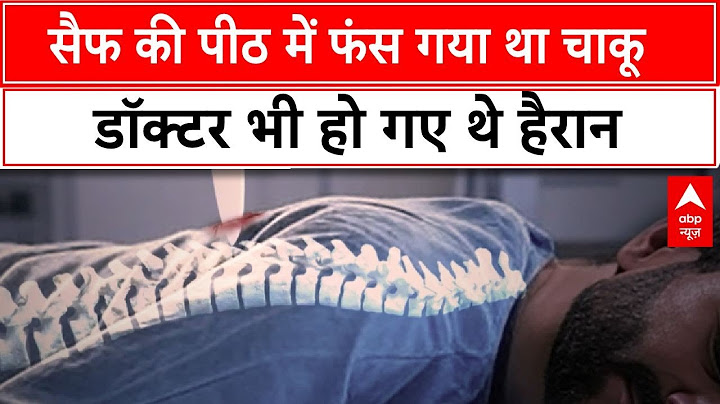 Saif Ali Khan Attacked: हमले के बाद सैफ की पीठ में फंस गया था चाकू, डॉक्टर भी हो गए थे हैरान
